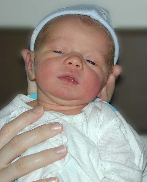 Dazed baby
